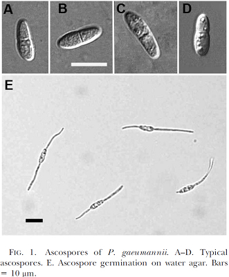 Ascospores and germinating ascospores on water agar