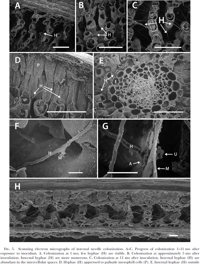 Scanning electron micrographs of internal needle colonization